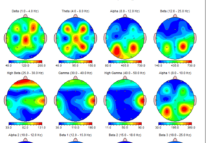 QEEG Brain Mapping